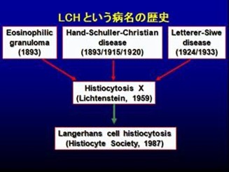 LCHという病名の歴史