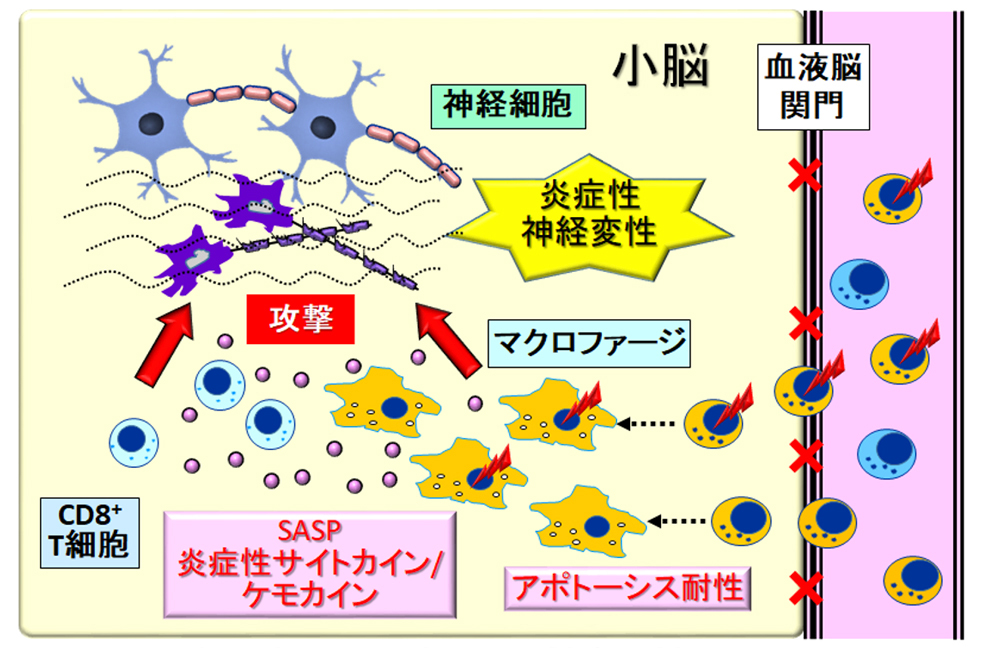 図4.BRAF V600E変異陽性単球形細胞による炎症性神経変性